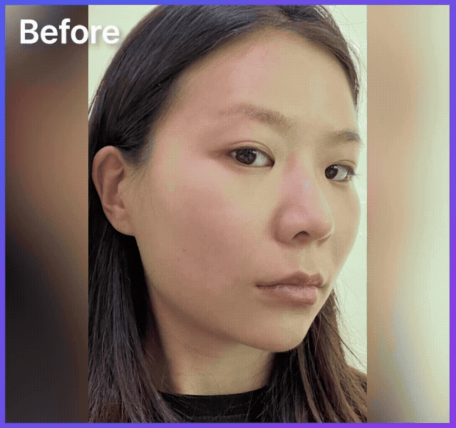 코 재수술 전문 원장